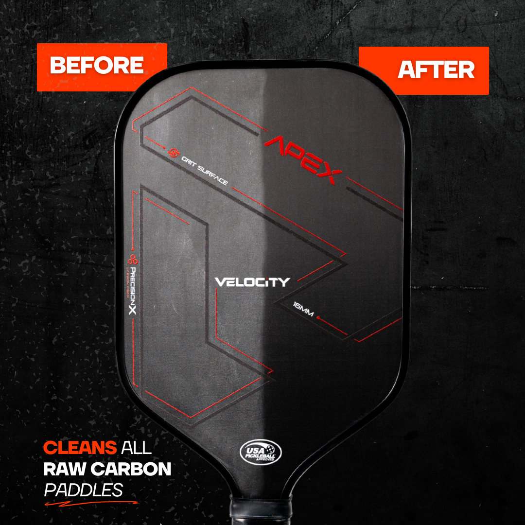 Apex Carbon Fiber Pickleball Paddle + Performance Kit (with Cover)